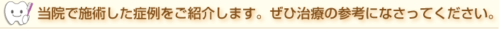 当院で施術した症例を紹介します。是非治療の参考になさってください。