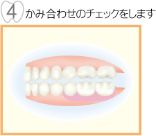 かみ合わせのチェックをします