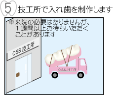 技工所で入れ歯を製作します