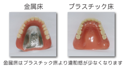 金属床とプラスチック床