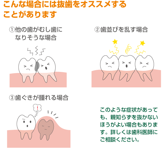 こんな場合には抜歯をオススメすることがあります